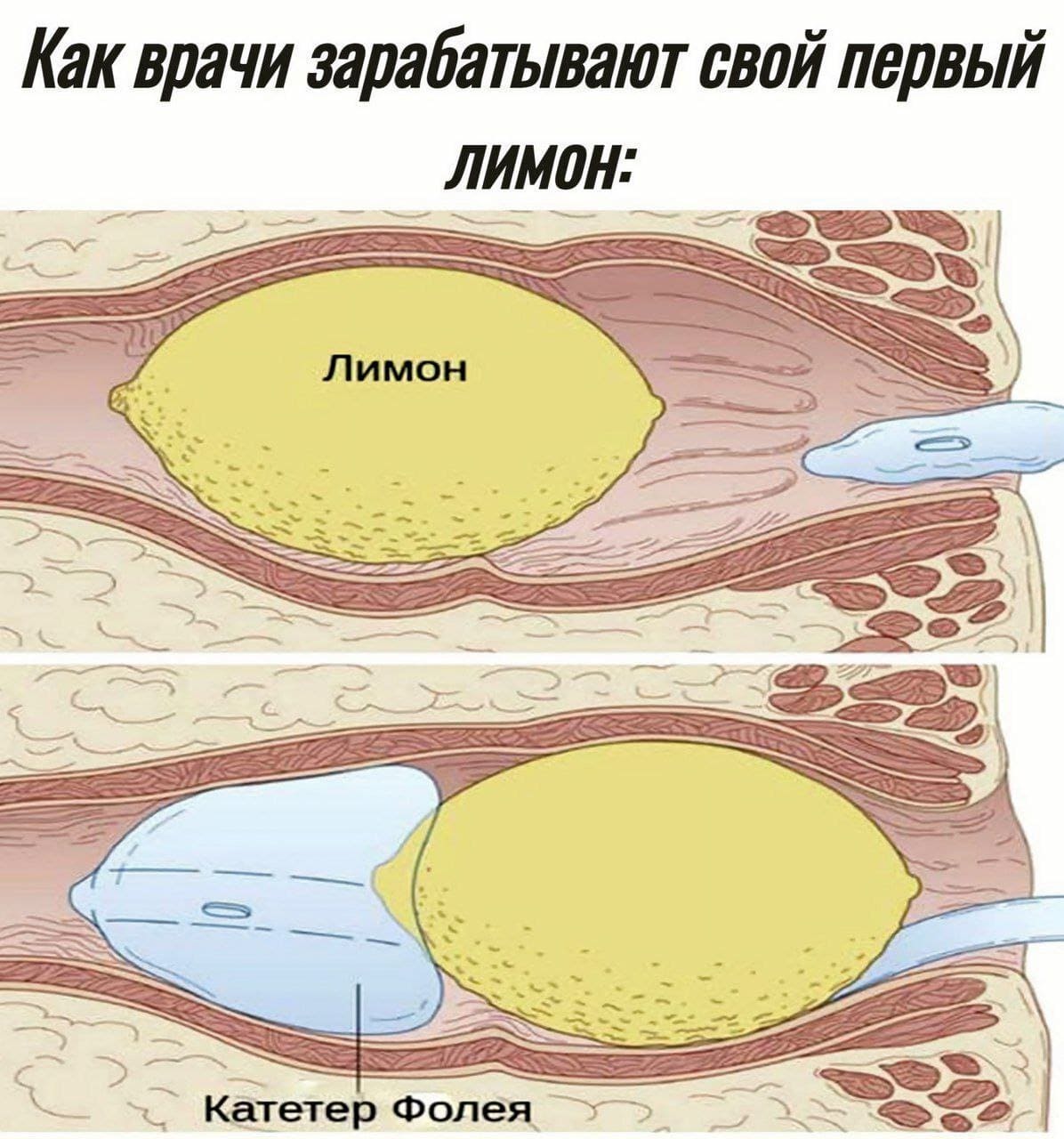 *Как врачи зарабатывают свой первый лимон*