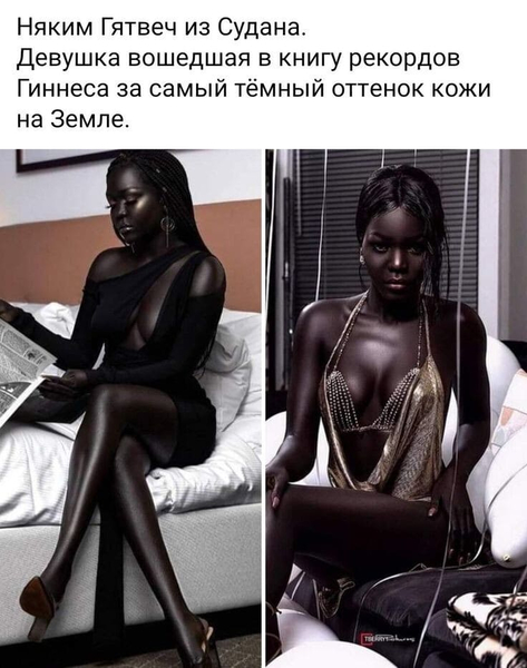 Няким Гятвеч из Судана.
Девушка вошедшая в книгу рекордов Гиннеса за самый тёмный оттенок кожи на Земле.