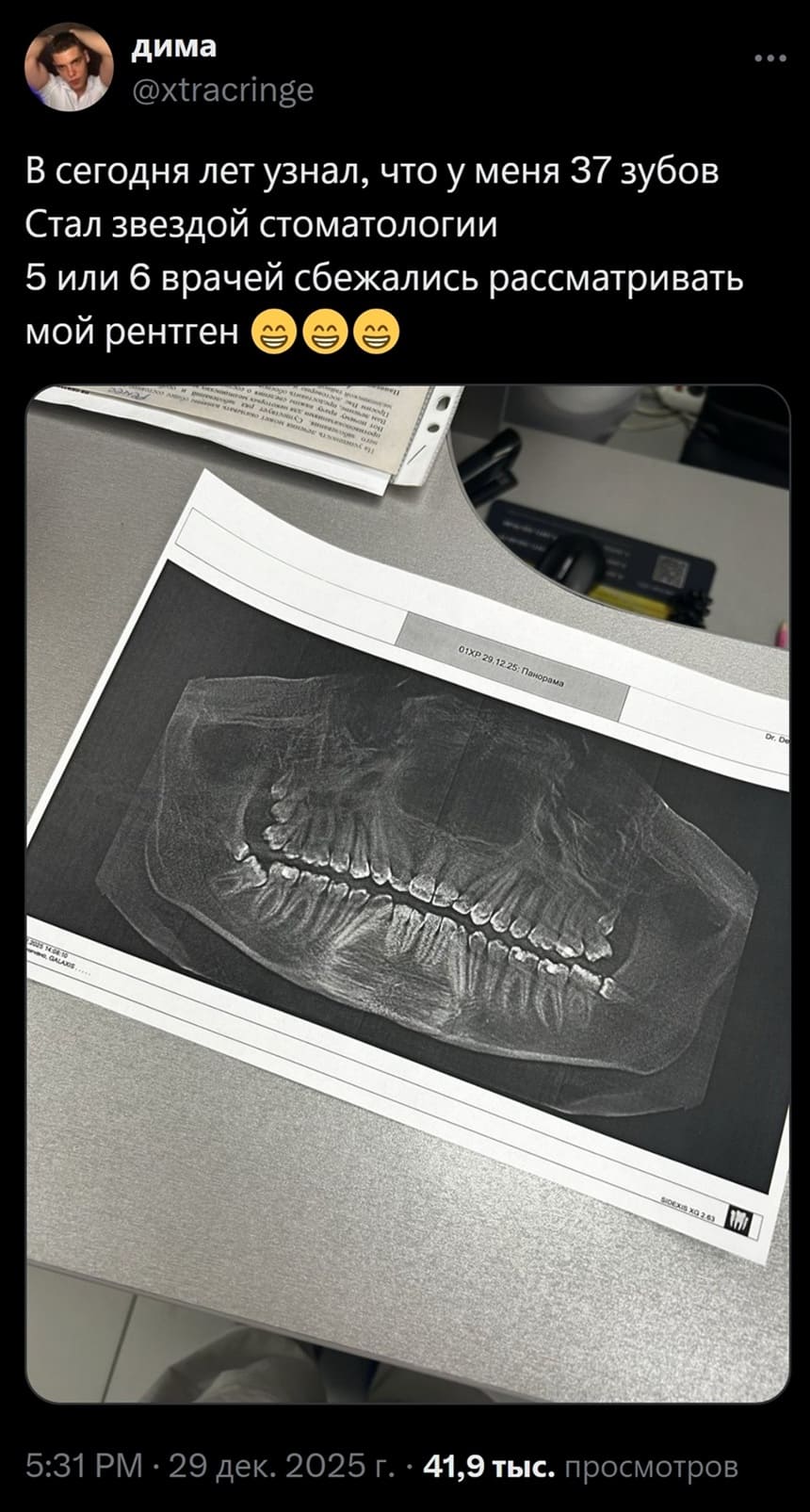 В сегодня лет узнал, что у меня З7 зубов. Стал звездой стоматологии. 5 или 6 врачей сбежались рассматривать мой рентген.