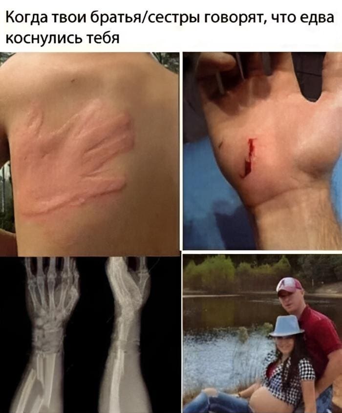 *Когда твои братья/сёстры говорят, что едва коснулись тебя*