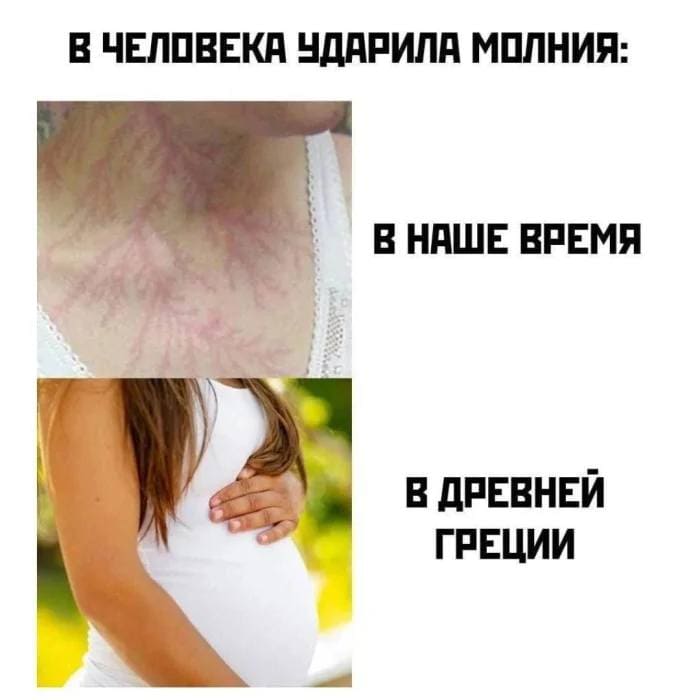 В ЧЕЛОВЕКА УДАРИЛА МОЛНИЯ:
*В наше время* — ожоги.
*Во времена Древней Греции* — непорочное зачатие.