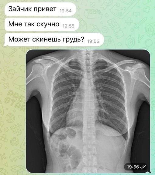 – Зайчик привет. Мне так скучно. Может скинешь грудь?