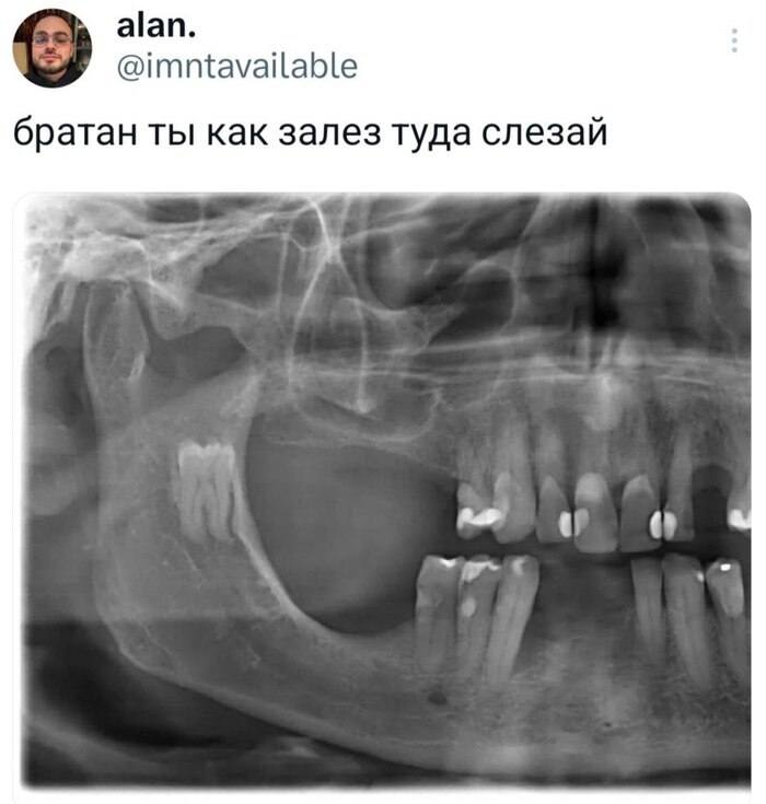 *Братан ты как залез туда, слезай*