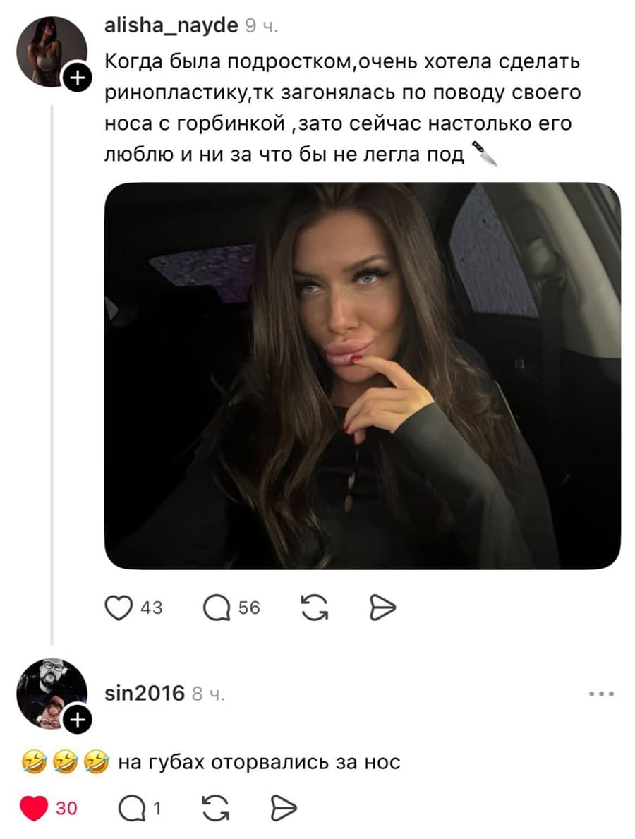 – Когда была подростком, очень хотела сделать ринопластику, так как загонялась по поводу своего носа с горбинкой, зато сейчас настолько его люблю и ни за что бы не легла под нож.
– На губах оторвались за нос.