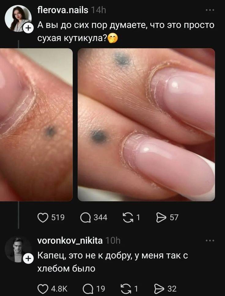 – А вы до сих пор думаете, что это просто сухая кутикула?
– Капец, это не к добру, у меня так с хлебом было.