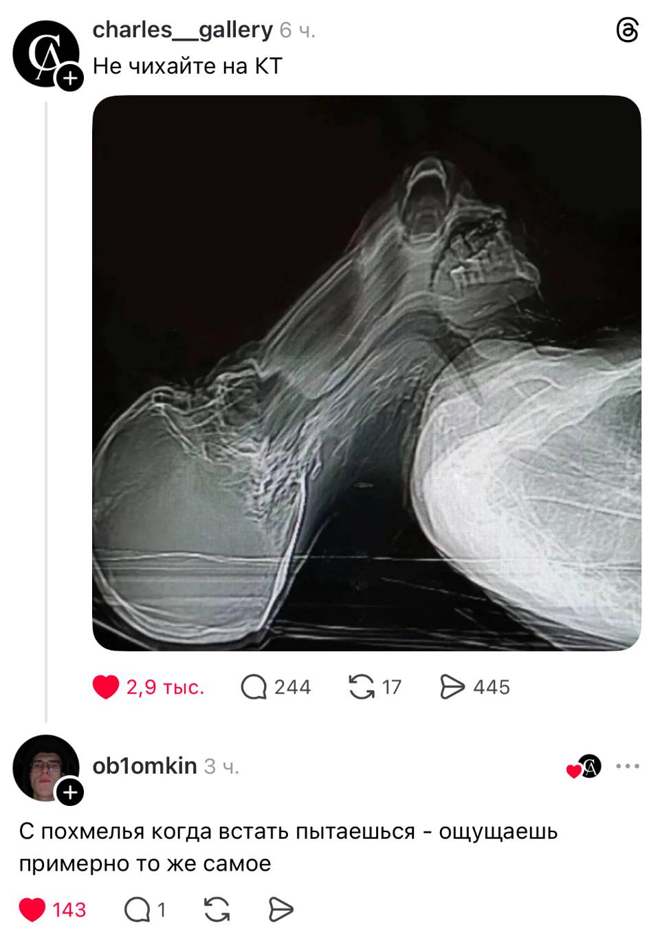 – Не чихайте на КТ
– С похмелья когда встать пытаешься — ощущаешь примерно то же самое.