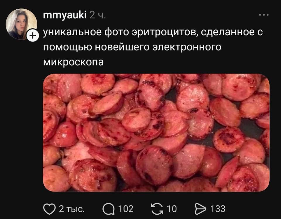 Уникальное фото эритроцитов, сделанное с помощью новейшего электронного микроскопа.