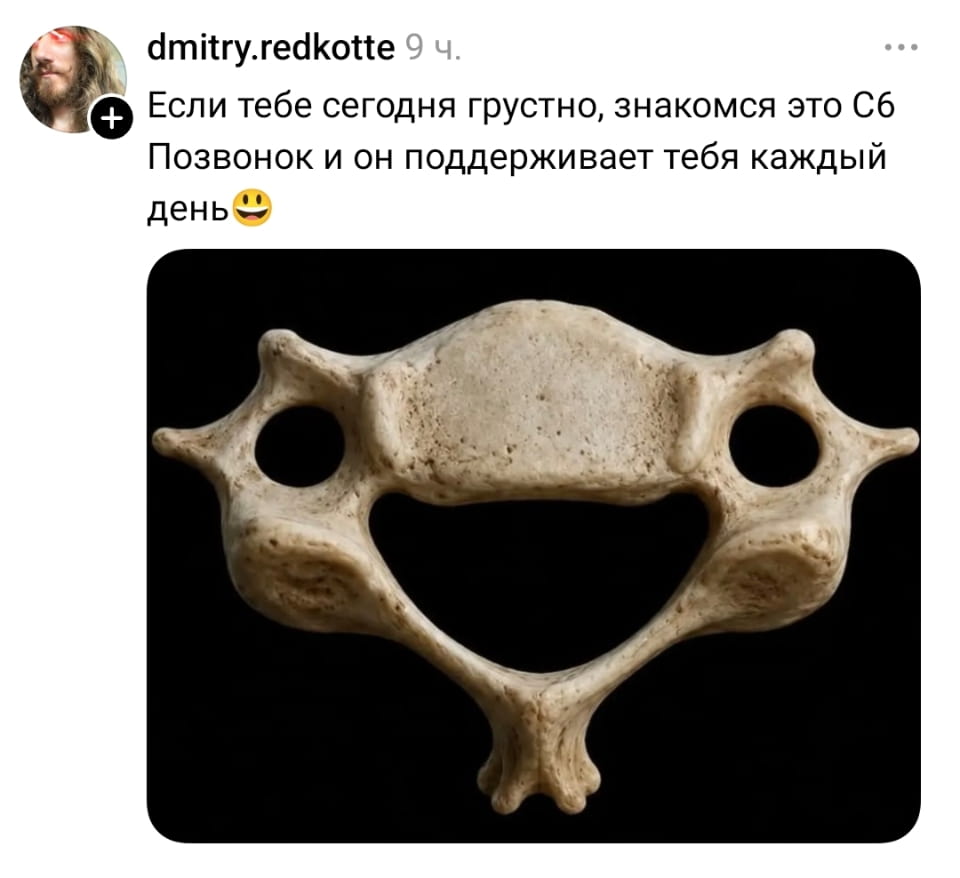 — Если тебе сегодня грустно, знакомься — это С6. Позвонок и он поддерживает тебя каждый день. 😃

Описание картинки:
С изображением позвонка, напоминающего улыбающееся лицо.