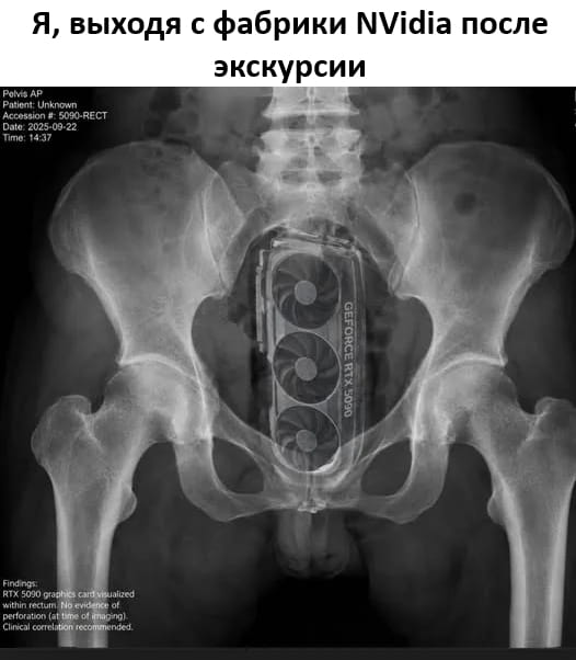 Я, выходя с фабрики NVidia после экскурсии.

Описание картинки:
Рентгеновский снимок с графической картой внутри тела.