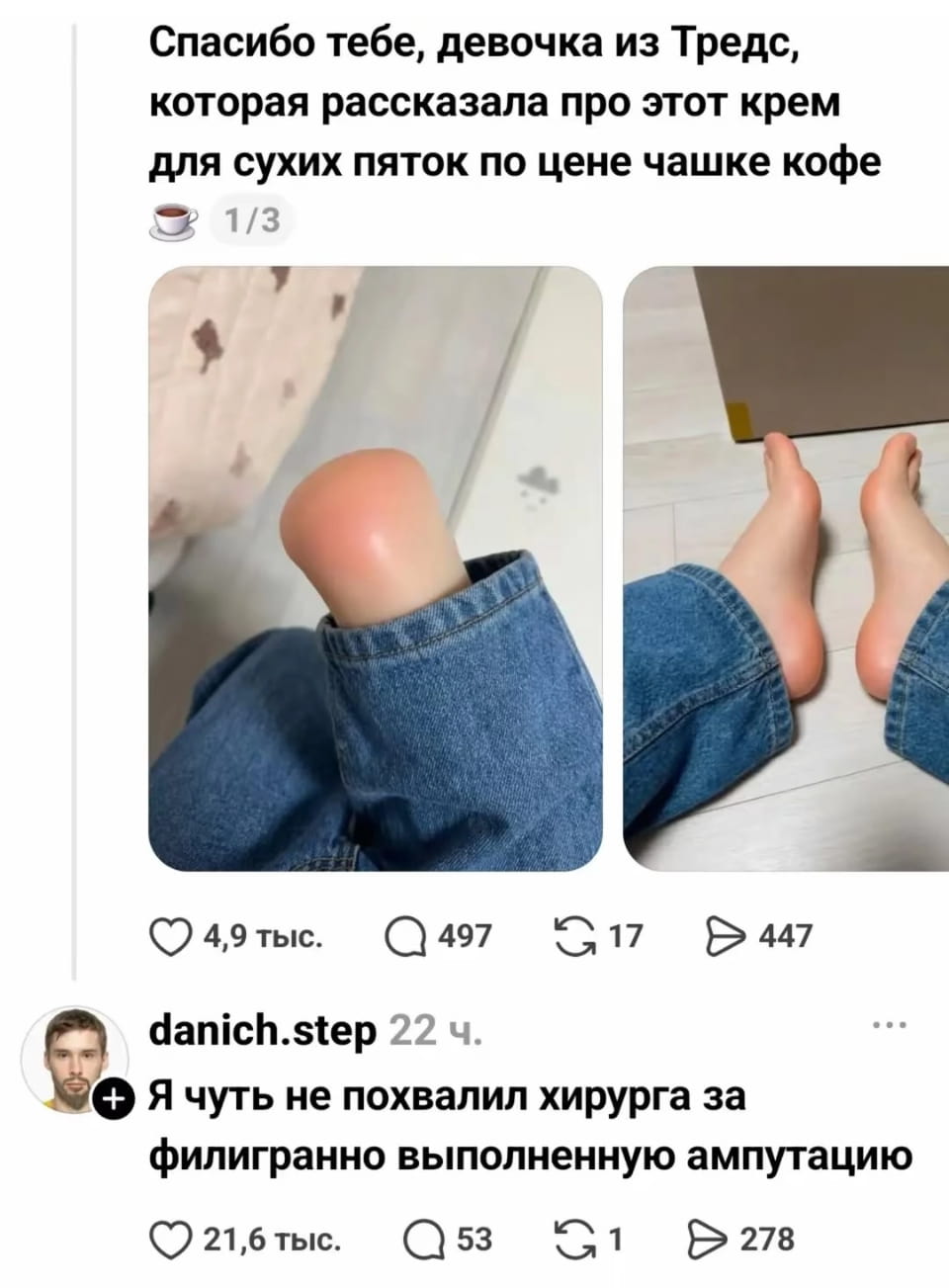 Спасибо тебе, девочка из Тредс, которая рассказала про этот крем для сухих пяток по цене чашке кофе

Я чуть не похвалил хирурга за филигранно выполненную ампутацию

Описание картинки:
Текст из соцсети про крем для пяток и реакцию на него.