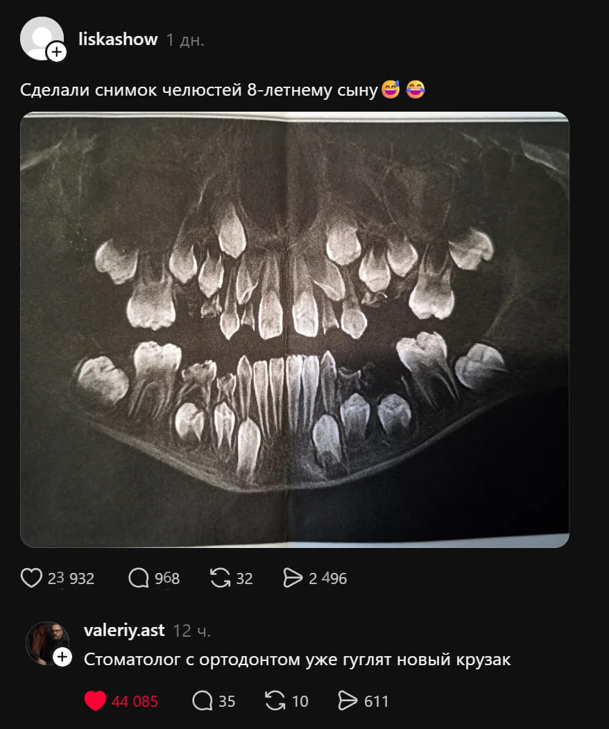 Сделали снимок челюстей 8-летнему сыну Стоматолог с ортодонтом уже гуглят новый крузак

Описание картинки:
Родители сделали снимок челюстей 8-летнему сыну, врачи гуглят новую машину.